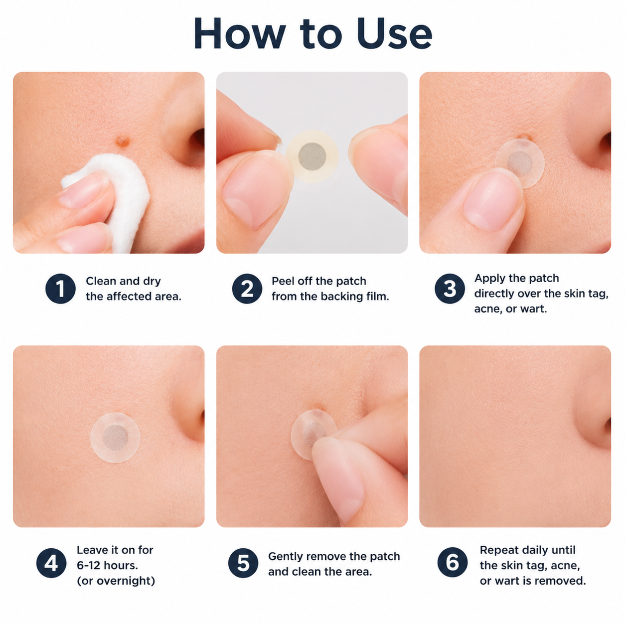 Hankihy® 2-in-1 Microneedle & Hydrocolloid Clear Patches  Targets Skin Tags, Flat Warts & Blemishes | Invisible Patch Technology for Face & Body