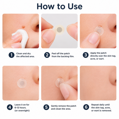 Hankihy® 2-in-1 Microneedle & Hydrocolloid Clear Patches  Targets Skin Tags, Flat Warts & Blemishes | Invisible Patch Technology for Face & Body