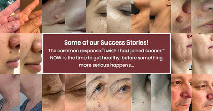Hankihy® 2-in-1 Microneedle & Hydrocolloid Clear Patches  Targets Skin Tags, Flat Warts & Blemishes | Invisible Patch Technology for Face & Body